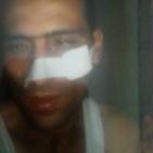 رام الله: قوات الاحتلال تعتقل شابا وتعتدي على اثنين من عائلته