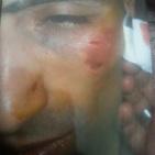 رام الله: قوات الاحتلال تعتقل شابا وتعتدي على اثنين من عائلته