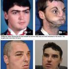 شاهد: رد فعل فتاة تشاهد لاول مره وجه شقيقها المتوفى بحادث سياره على جسد شاب اخر