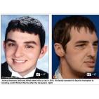 شاهد: رد فعل فتاة تشاهد لاول مره وجه شقيقها المتوفى بحادث سياره على جسد شاب اخر