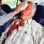 بالصور: اصابة مواطن اثر اعتداء مستوطنين عليه قرب نابلس