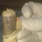 بالصور.. استخراج لفافة بها 1000 جنيه من معدة مصري