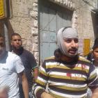 اصابة فلسطيني بعد اعتداء المستوطنين عليه في الخليل