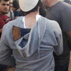 بالصور- اصابة مواطنين في هجوم ببلطة نفذه مستوطن غرب سلفيت