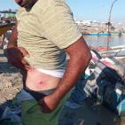 بالصور: إصابة صياد برصاص زوارق الاحتلال في بحر شمال غزة