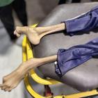 منعطف خطير بمسار الكارثة.. استشهاد شاب بسبب الجوع في غزة