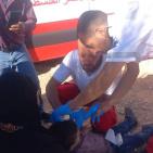 إصابات غالبيتهم نساء وأطفال في هجوم للمستوطنين بمسافر يطا