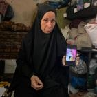 قصة مصورة| أحمد.. إصابةٌ كان يمكن علاجها فانتهت ببتر ساقه