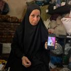 قصة مصورة| أحمد.. إصابةٌ كان يمكن علاجها فانتهت ببتر ساقه