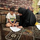 قصة مصورة| أحمد.. إصابةٌ كان يمكن علاجها فانتهت ببتر ساقه