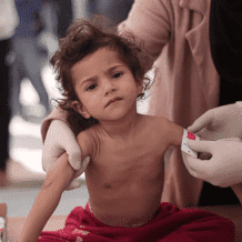  ارتفاع غير مسبوق بمعدلات سوء التغذية في غزة