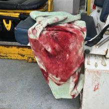 إصابة طفلين برصاص الاحتلال شرق مخيم المغازي وسط غزة