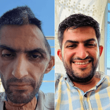نادي الأسير: صورة الصحفي مجاهد بني مفلح تختزل حقيقة السجن الإبادي الإسرائيلي