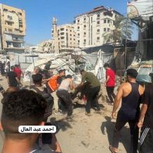 إصابات جراء قصف الاحتلال خيمة نازحين وسط مدينة غزة