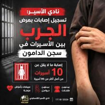 نادي الأسير: تسجيل إصابات بمرض الجرب (السكابيوس) بين صفوف الأسيرات في سجن الدامون