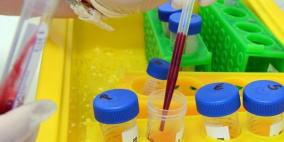 قريباً .. إجراء تحليل الكولسترول دون الحاجة إلى الصوم  