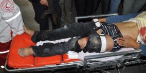 صور أولية لجريمة غزة 5 شهداء و30 جريح