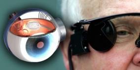 "العين الإلكترونية" فرصة جديدة للمصابين بالعمى