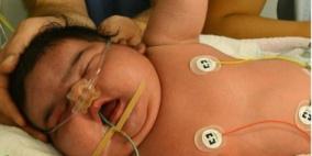 ألمانية تضع مولودة عملاقة تزن 6 كيلوجراماً