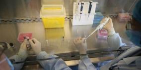 إنفلونزا الخنازير تصل إلى مستشار وزير العدل المصري