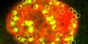 علاج الأورام السرطانية باستخدام الأشعة الإيونية