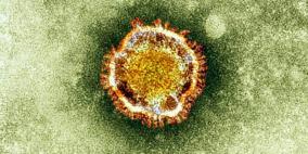 الشرق الأوسط... انتشار وباء فيروس كورونا الخطير