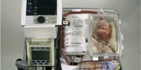 جراحون يزرعون "قلبا ميتا" بعد إنعاشه