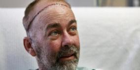 لأول مرة.. زراعة جمجمة وفروة رأس لمريض بالسرطان