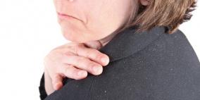 فطريات في فروة الرأس هي مسبب القشرة