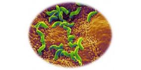 مواد غذائية طبيعية.. وسيلة لمكافحة "جرثومة المعدة"