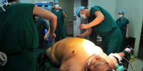 متى يكون تضييق المعدة جراحيا ضروريا؟