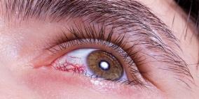 نصائح بسيطة لوقاية العين من الأمراض