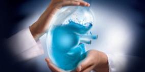 حصى الكلى.. العطش بيت الداء والماء الوقاية