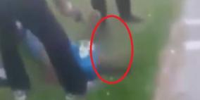 نتائج تشريح الشهيد "الشلودي"