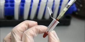 سرطان عنق الرحم يقتل امرأة كل ساعة بالشرق الأوسط