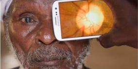 تطبيق للهواتف الذكية قادر على تشخيص أمراض العين