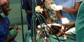 أوغندا.. ولادة طفل بـ" أربع أرجل وأربع أذرع"