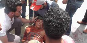 بالصور: إصابة طفل بجراح خطيرة إثر مطاردته من قبل جيب إسرائيلي