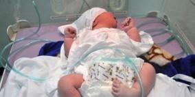 طبيبة عراقية تحذر من تزايد التشوهات الخلقية للمواليد