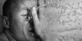 4 حلول للخلاص من التعرّق الزائد