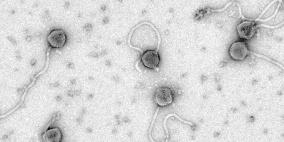 عاثية فعالة للقضاء على الجمرة الخبيثة