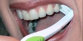 7 أمراض وممارسات خاطئة تسبب رائحة الفم الكريهة