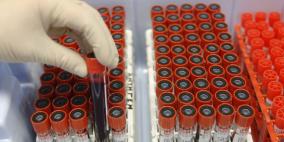 زمرة دمك تكتشف لك مسبقا ما قد يلم بك من أمراض مستقبلا