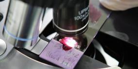 فحص للدم يكشف جميع الفيروسات التي أصبت بها بحياتك