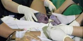 أول طفل فى 2013 ولد بأسبانيا بعد 30 ثانية من الساعة 12 صباحا
