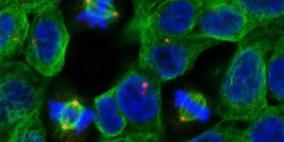 نظارات تتيح للجراحين مشاهدة السرطان