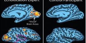 دراسة: بعض المكفوفين مثل الخفاش يتعرفون على الأشياء بواسطة ارتداد موجات الصوت