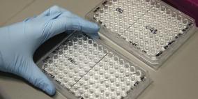 الكونغو تعلن خلو حالات مشتبه بها من فيروس الإيبولا