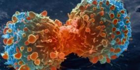 20 ألف إصابة بسرطان الرئة بين النساء سنويا في بريطانيا