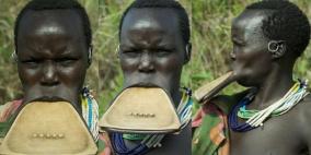 تكبير الشفتين من دون جراحة تجميلية